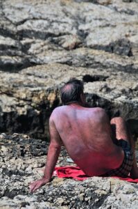 Risk of diseases from contaminated water and food in summer